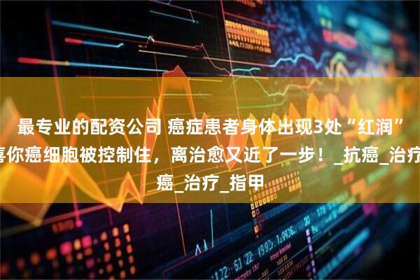 最专业的配资公司 癌症患者身体出现3处“红润”，恭喜你癌细胞被控制住，离治愈又近了一步！_抗癌_治疗_指甲